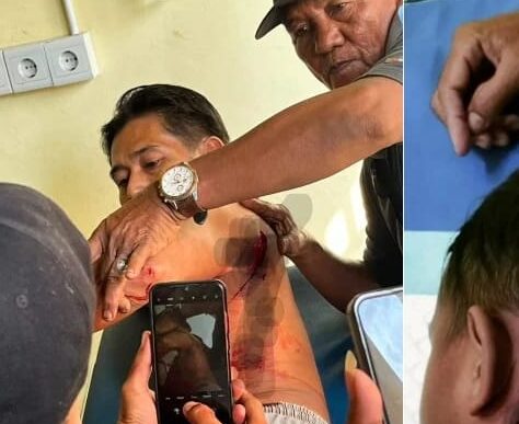 Breaking News: Korban Gigitan Monyet Liar di Inhil Bertambah Jadi 15 Orang, Seorang Anak Digigit di Bagian Leher